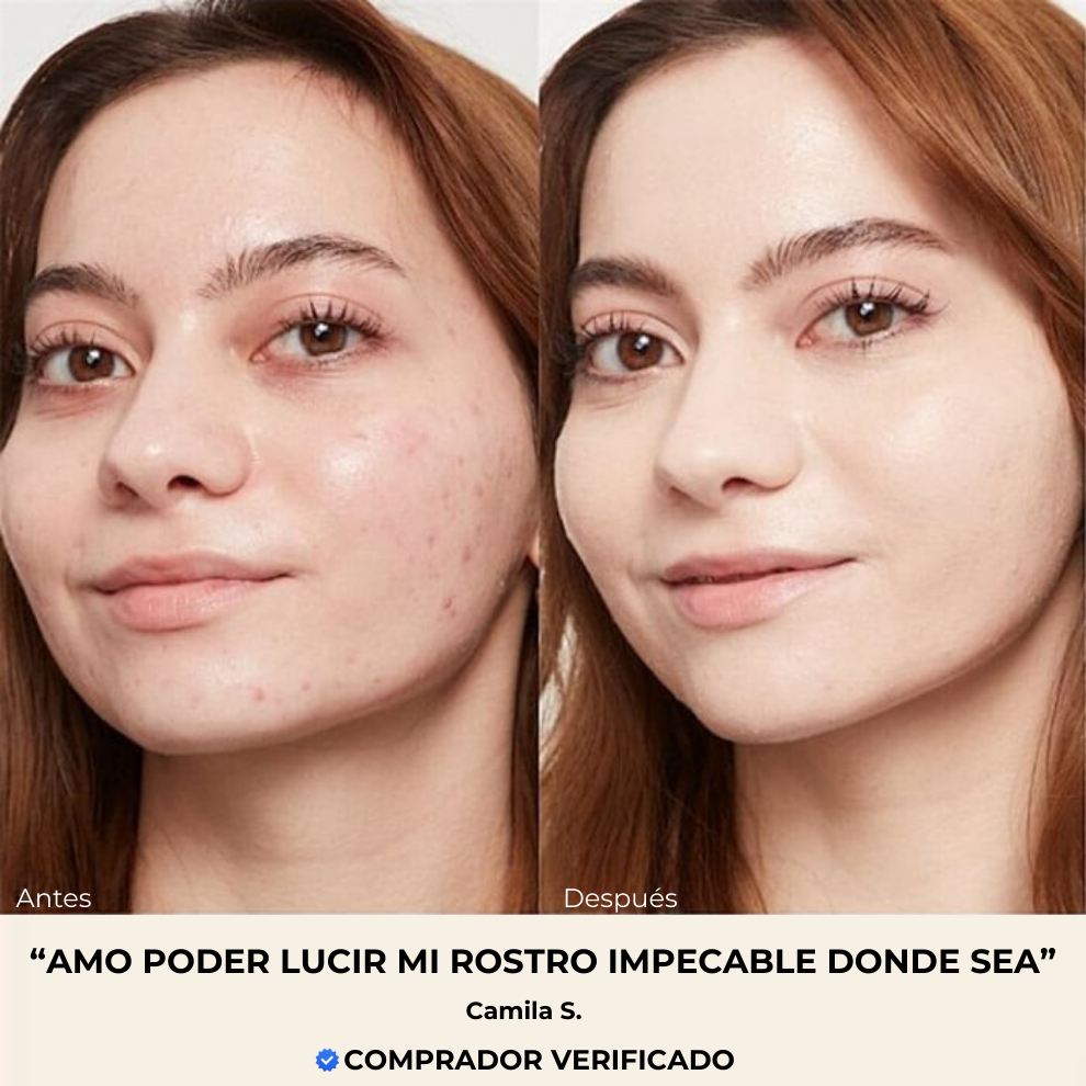 LUNEA® Base Biomimic 4-1